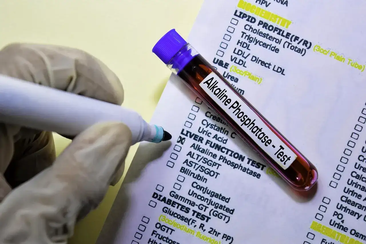 Rękawiczka w rękawiczce zaznacza krzyżykiem test na alkaliczną fosfatazę (ALP) na formularzu badań.