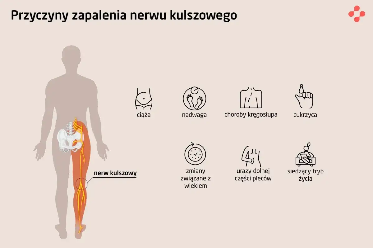 Ilustracja przedstawia ludzką sylwetkę z zaznaczonym nerwem kulszowym i jego przebiegiem. Obok ikony symbolizujące przyczyny zapalenia nerwu kulszowego: ciąża, nadwaga, choroby kręgosłupa, cukrzyca, zmiany związane z wiekiem, urazy dolnej części pleców...