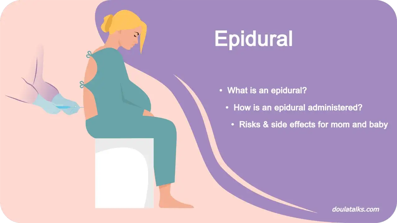 Una mujer embarazada recibe una epidural. La imagen ilustra la administraci&oacute;n y los posibles efectos secundarios de la epidural.
