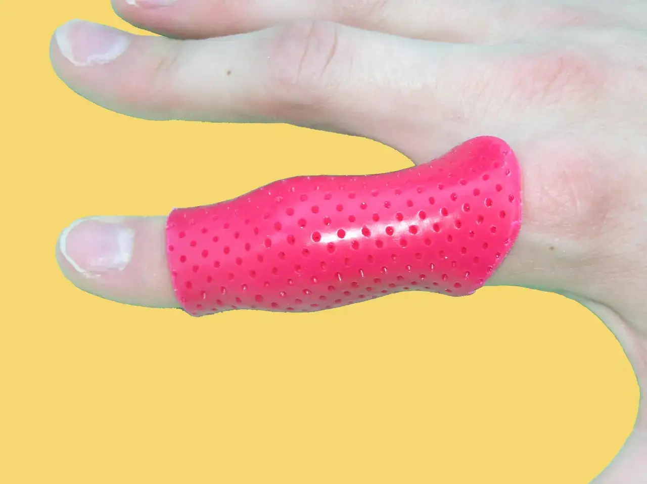 Orthoplastie rose perfor&eacute;e sur un doigt, offrant un soutien doux et une protection pour une gu&eacute;rison optimale.