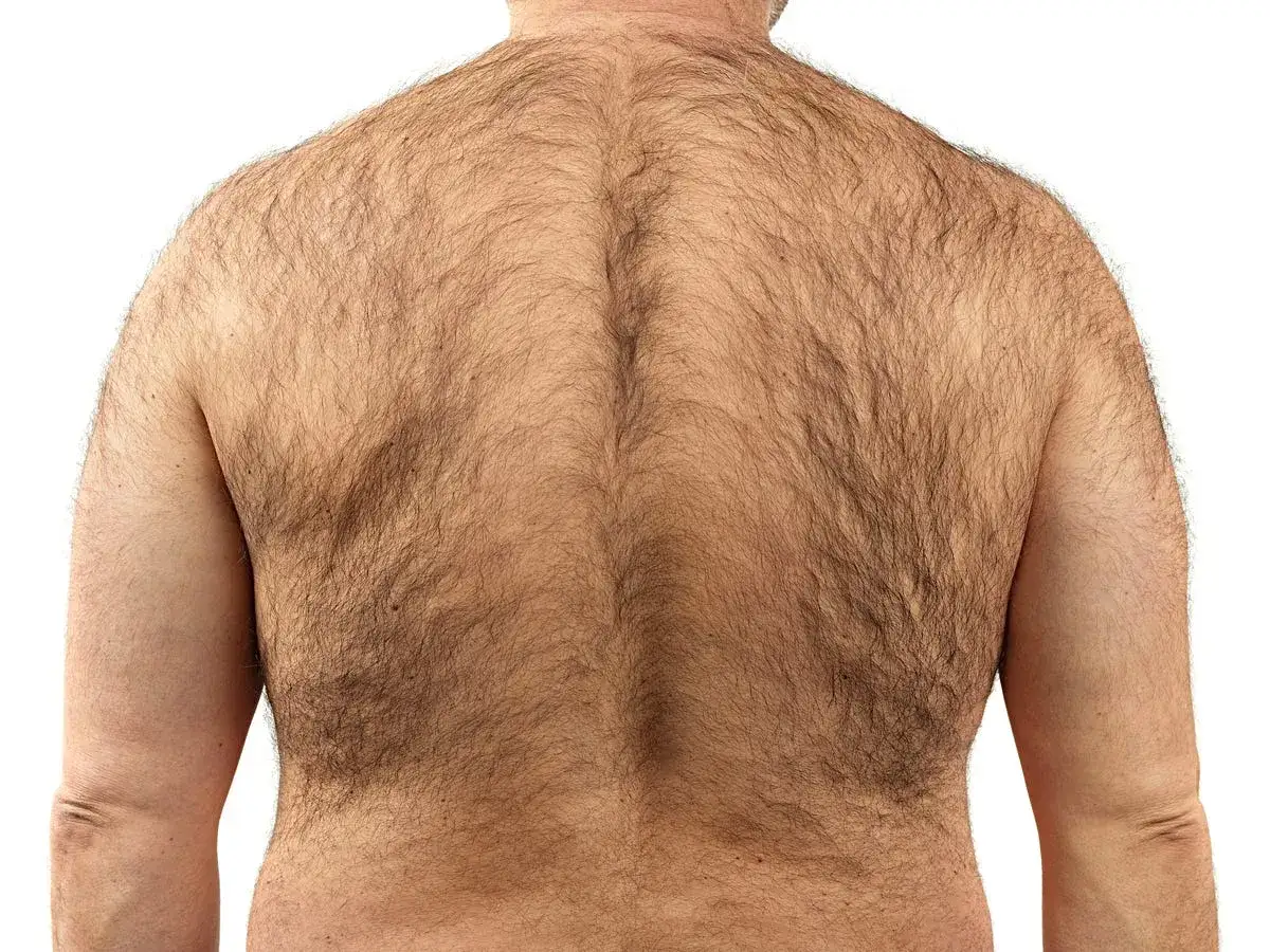 Espalda masculina con vello abundante. Una gu&iacute;a visual para quienes buscan c&oacute;mo depilarse la espalda uno mismo.