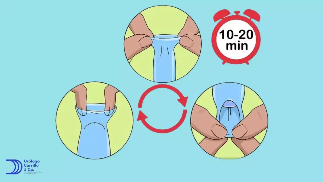 Ilustración muestra cómo retirar el prepucio en niños, evitando la acumulación de esmegma. Se indica un tiempo de 10-20 minutos.