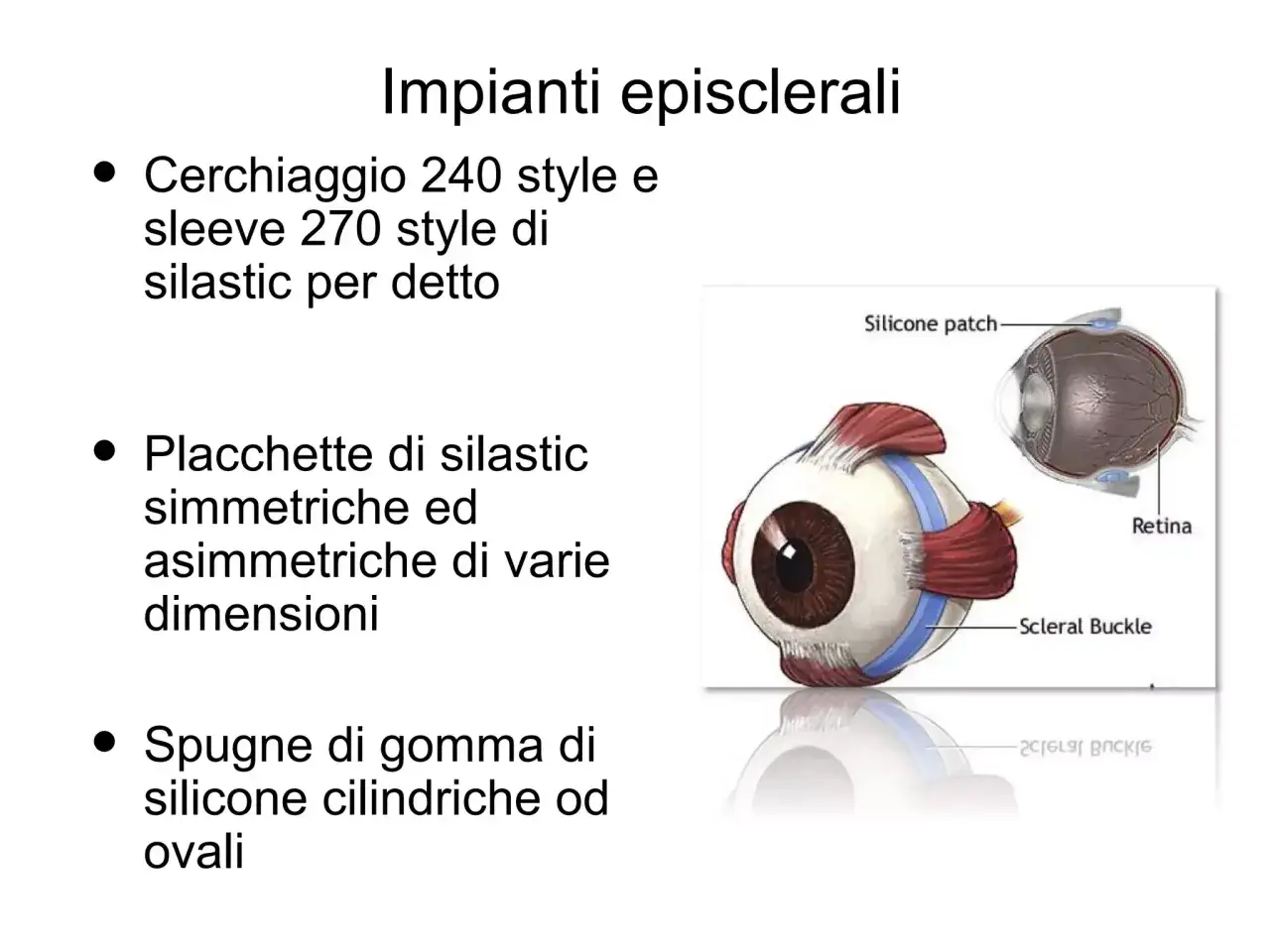 Impianti episclerali: cerchiaggi, placchette e spugne di silicone per il piombaggio della retina. Illustrazione anatomica dell'occhio.