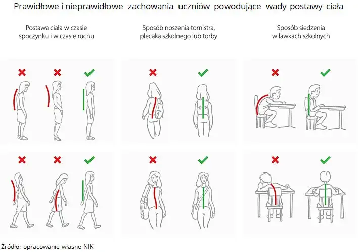 wady postawy u dzieci schemat