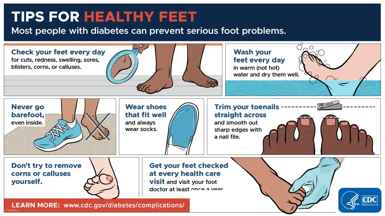 Conseils pour des pieds sains : v&eacute;rifiez vos pieds, lavez-les, portez des chaussures adapt&eacute;es et ne retirez pas vous-m&ecirc;me un ampoule ou un cor.