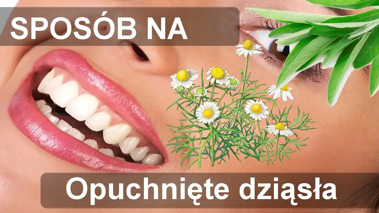 Zdjęcie Domowe sposoby na opuchnięte dziąsła – jak szybko złagodzić ból i obrzęk