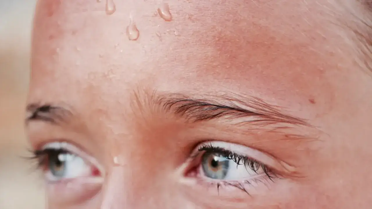 Gotas de sudor en la frente de una persona. &iquest;Buscas trucos para no sudar por la cabeza?