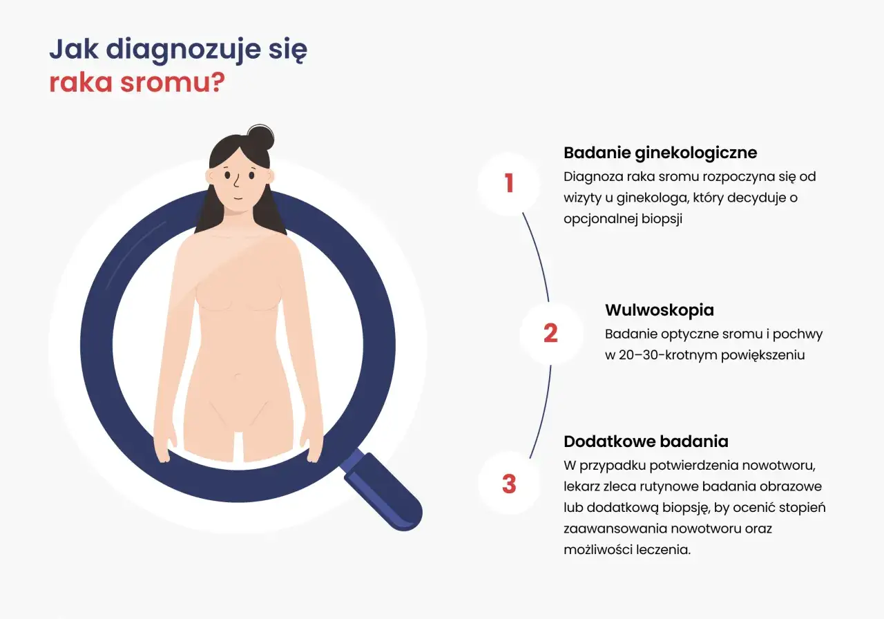 Ilustracja przedstawia schemat diagnozowania raka sromu: wizyta u ginekologa, wulwoskopia i dodatkowe badania.