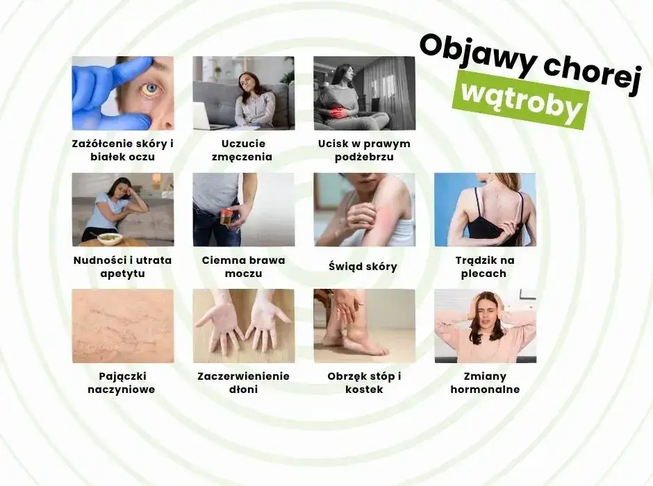 objawy powiększonej wątroby grafika