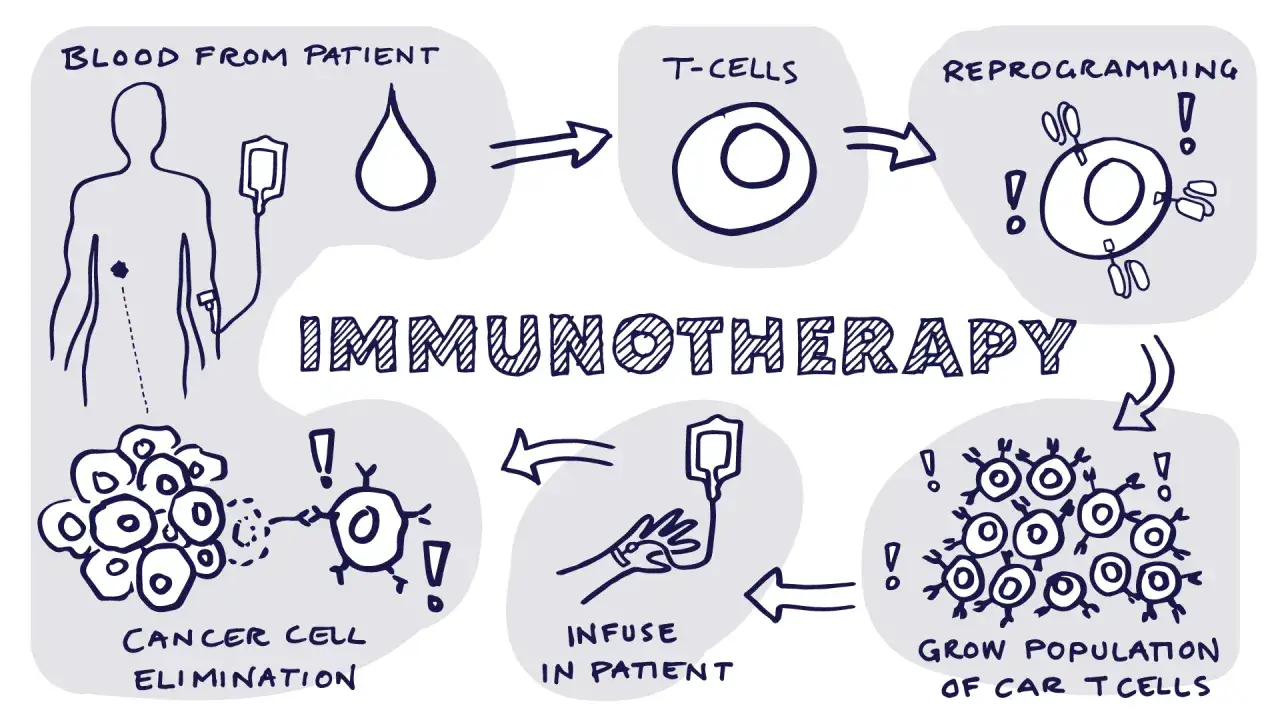 Schema erklärt, was eine Immuntherapie ist: Blutentnahme, T-Zellen-Reprogrammierung, Vermehrung, Infusion und Krebszellen-Eliminierung.