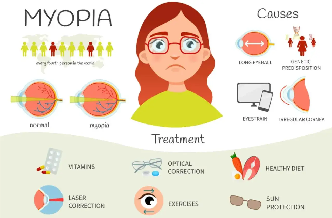 Infografica sulla miopia patologica: cause (occhio allungato, genetica, affaticamento visivo, cornea irregolare) e trattamenti (vitamine, correzione ottica, laser, esercizi, dieta, protezione solare).