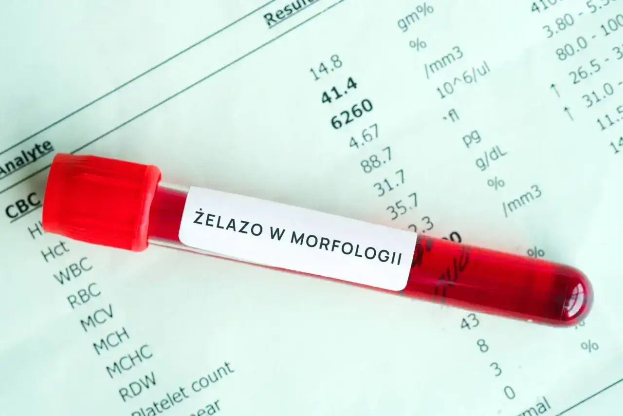 Prob&oacute;wka z krwią na tle wynik&oacute;w badań. Etykieta na prob&oacute;wce głosi 