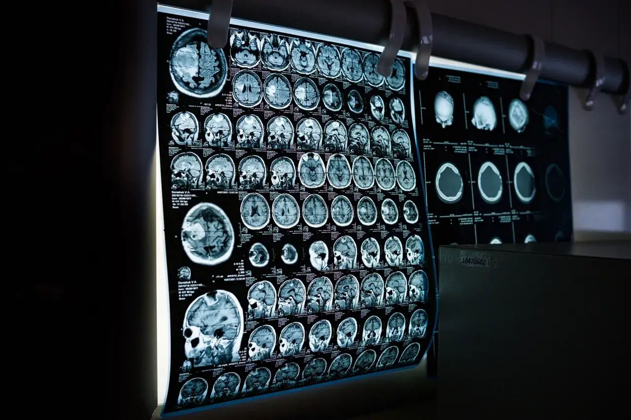 Nowoczesne środki kontrastowe MRI