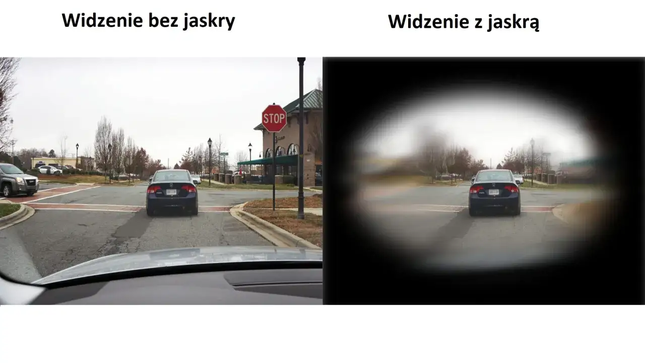 Porównanie widzenia: po lewej wyraźne, po prawej zamazane, co ilustruje objawy jaskry u seniora.