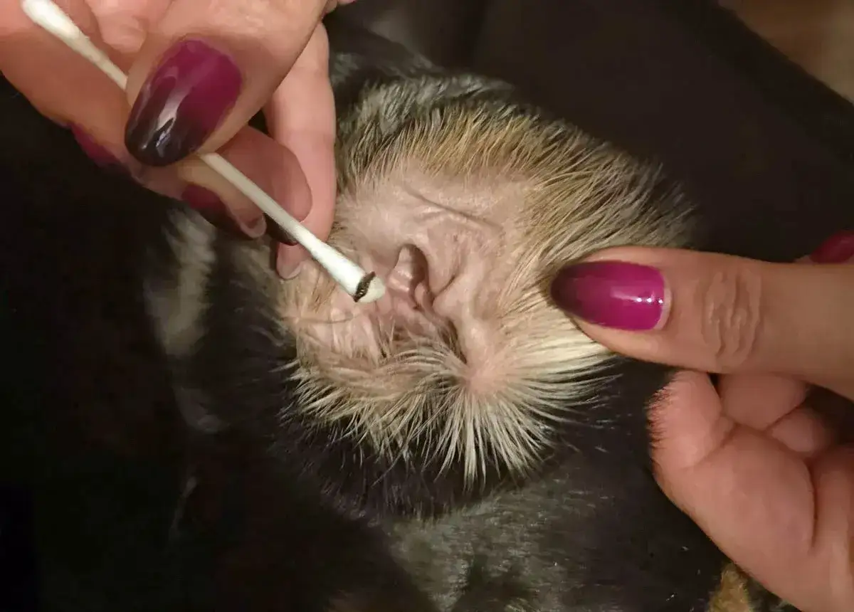 Czyszczenie ucha z objawami grzybicy przy użyciu patyczka nasączonego wodą utlenioną.
