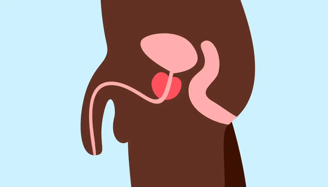 Illustration simplifi&eacute;e du syst&egrave;me reproducteur masculin, montrant la vessie, la prostate et les testicules. Une l&eacute;g&egrave;re g&ecirc;ne, comme un testicule qui gratte, peut survenir.