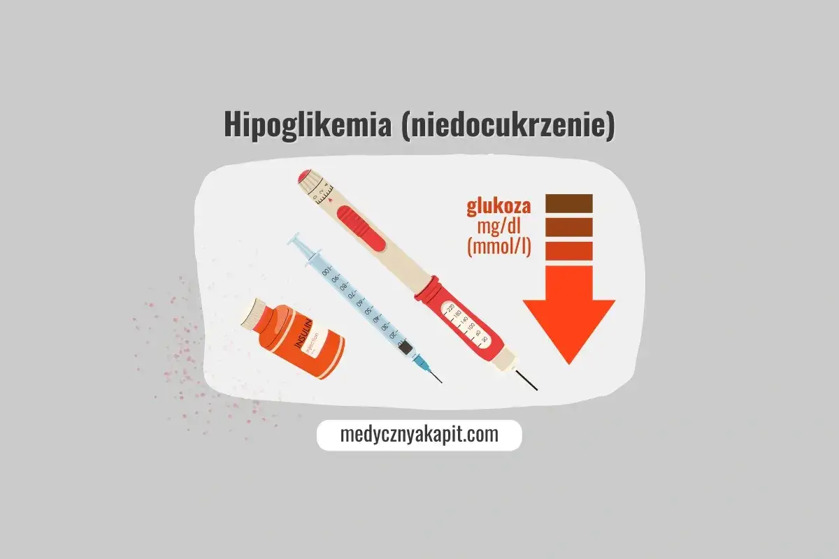 Ilustracja przedstawia przybory do podawania insuliny i strzałkę wskazującą spadek poziomu glukozy, symbolizując objawy hipoglikemii.