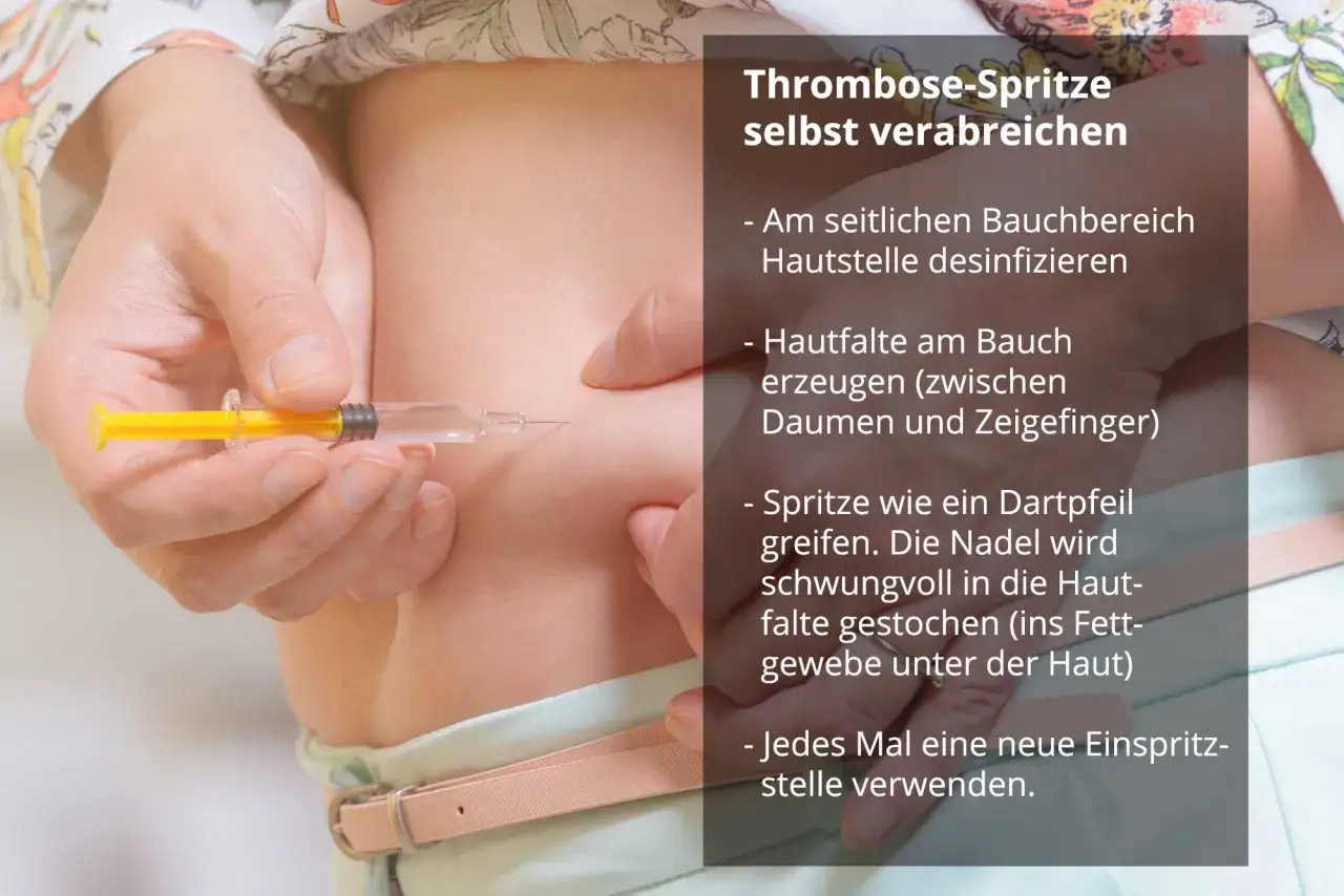 Anleitung zur Selbstinjektion einer Thrombosespritze. Positive enoxaparin becat erfahrungen sind wichtig für die korrekte Anwendung.