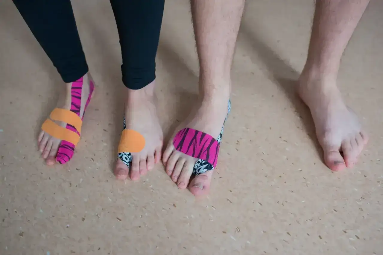 Stopy po operacji haluksa, z kolorowymi plastrami kinezjotaping. Rehabilitacja trwa, 4 miesiące po operacji haluksa.