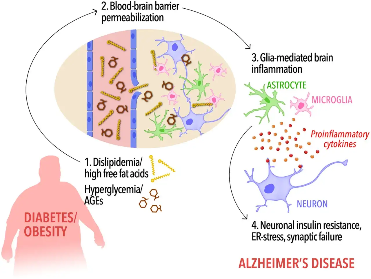 Schemat przedstawia mechanizm cukrzycy typu 3, łącząc otyłość i dyslipidemię z zapaleniem mózgu i chorobą Alzheimera.