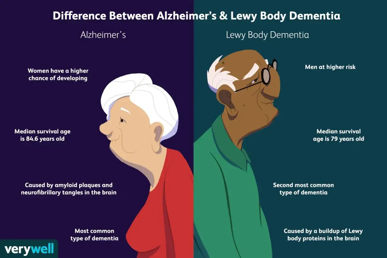 Ilustración compara Alzheimer y demencia con cuerpos de Lewy. Hombre con demencia con cuerpos de Lewy, hombre con mayor riesgo.