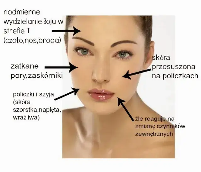 cera mieszana strefa T policzki