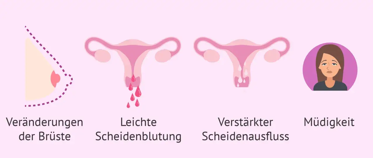 Brustver&auml;nderungen, leichte Scheidenblutung, verst&auml;rkter Ausfluss und M&uuml;digkeit k&ouml;nnen Anzeichen sein, dass die periode bleibt aus.