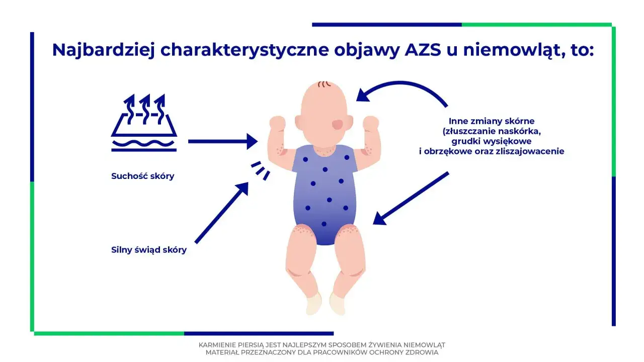 Niemowlę z atopowym zapaleniem skóry (AZS) ma suchą, swędzącą skórę, a także inne zmiany skórne, jak złuszczanie naskórka czy grudki.
