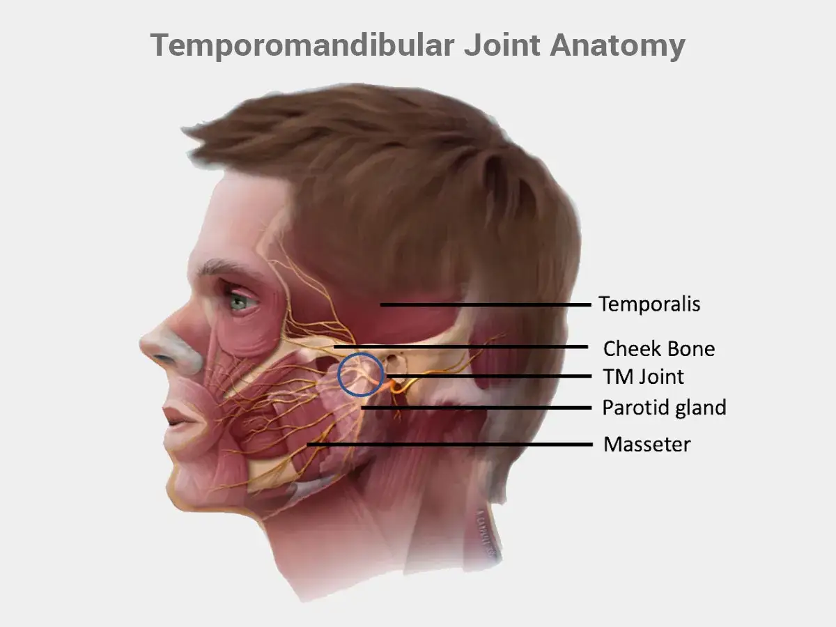 Anatomia stawu skroniowo-żuchwowego, z zaznaczonym obszarem, który może powodować ból szczęki.
