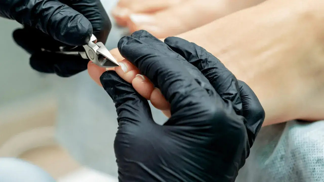 Dłoń w czarnej rękawiczce precyzyjnie przycina paznokieć u stopy, przygotowując go do rekonstrukcji.