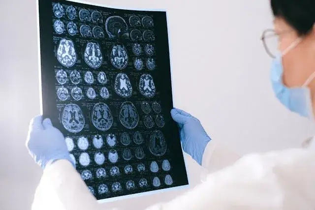 Zdjęcie Guz mózgu objawy psychiczne: jak rozpoznać niebezpieczne sygnały
