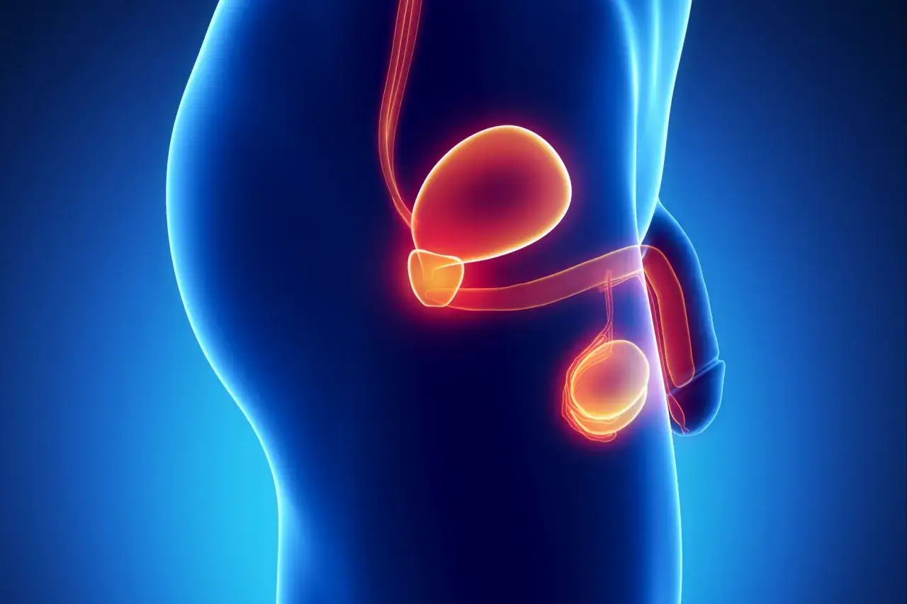 Anatomia męskiego układu rozrodczego z podświetloną prostatą, sugerującą przerost gruczołu krokowego.