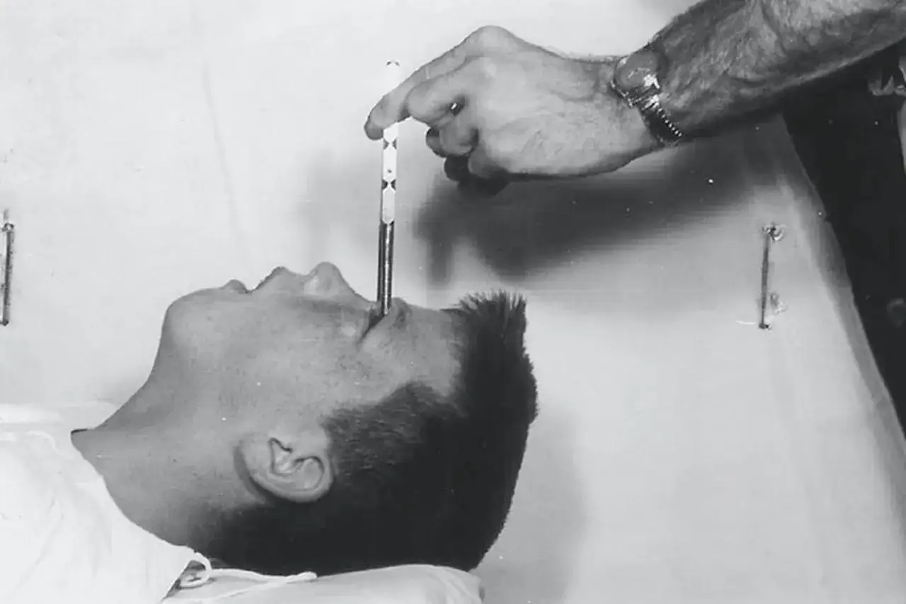 En hand för in en lobotomikniv in i en patients öga. En mörk tid i psykiatrins historia, även i Sverige.