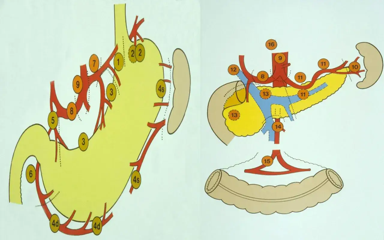 Anatomische Darstellung der Magen- und Pankreasgefäße, wichtig für die Planung einer Magenkrebs Operation.