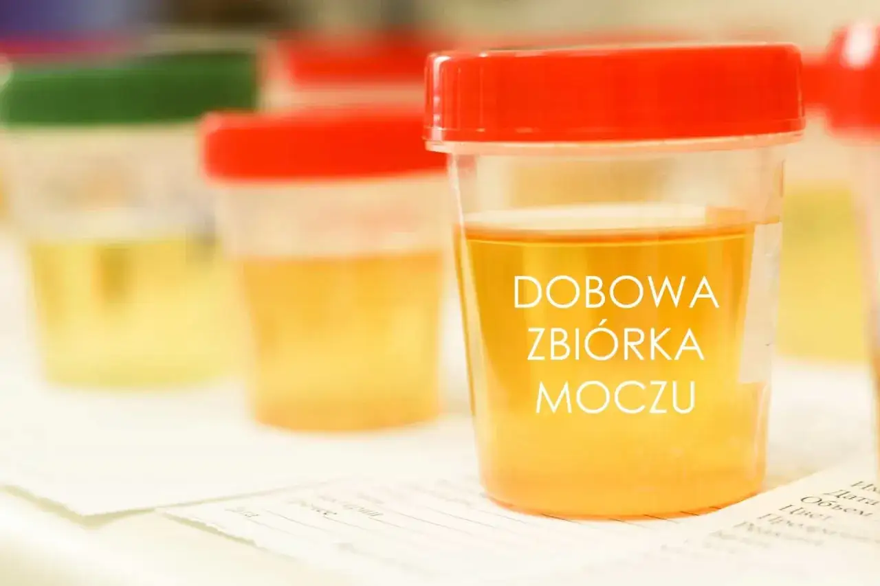 zestaw do badania moczu dobowa zbiórka