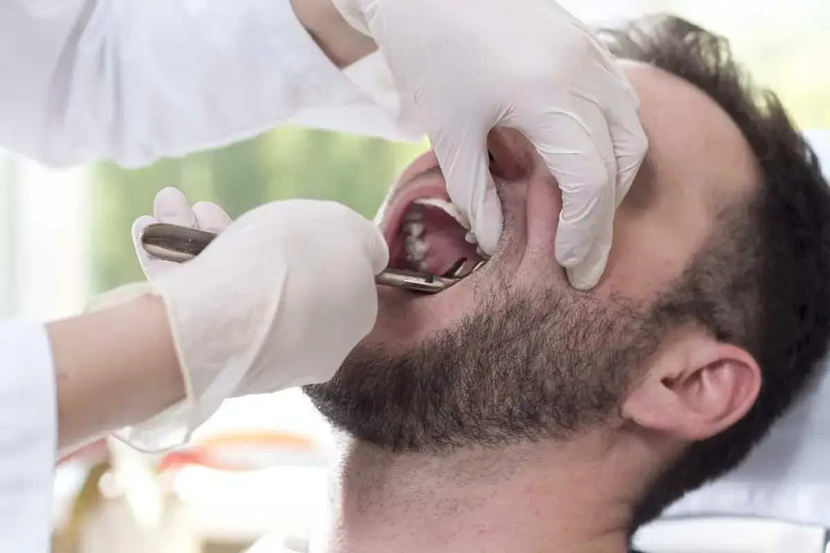 Dentysta w białej rękawiczce używa kleszczy do ekstrakcji zęba. Pytanie, czy suchy zębodół sam się zagoi, jest kluczowe dla pacjenta.