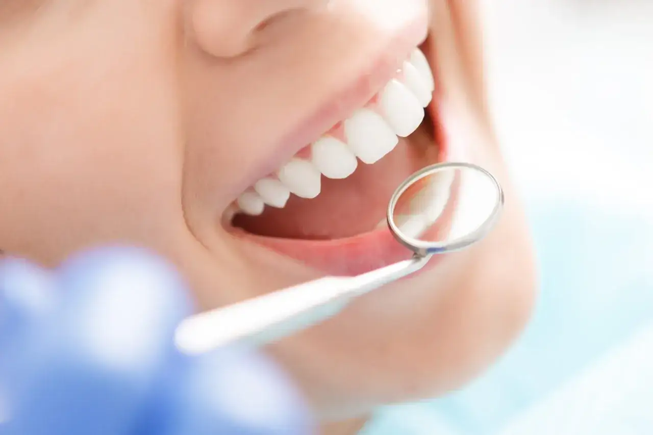 Uśmiechnięte usta z białymi zębami podczas higienizacji. Dentysta używa lusterka do kontroli.