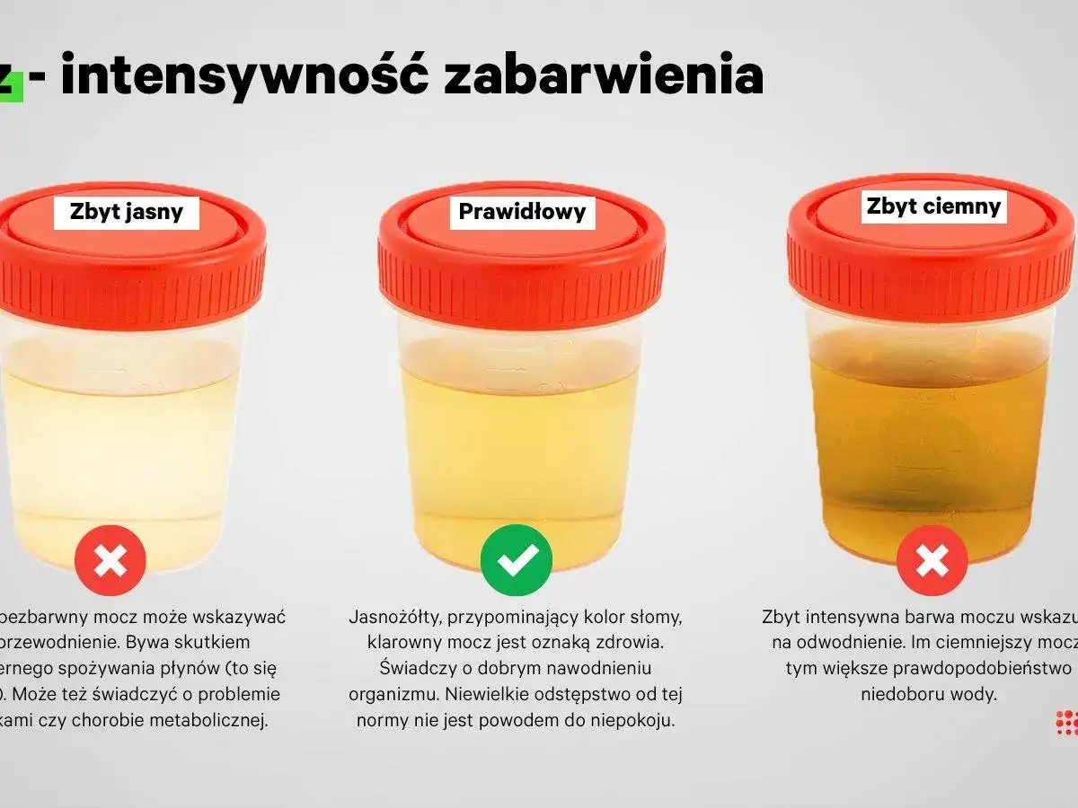 Trzy pojemniki z moczem: zbyt jasny, prawidłowy i zbyt ciemny. Jasny mocz może świadczyć o odwodnieniu lub problemach zdrowotnych.