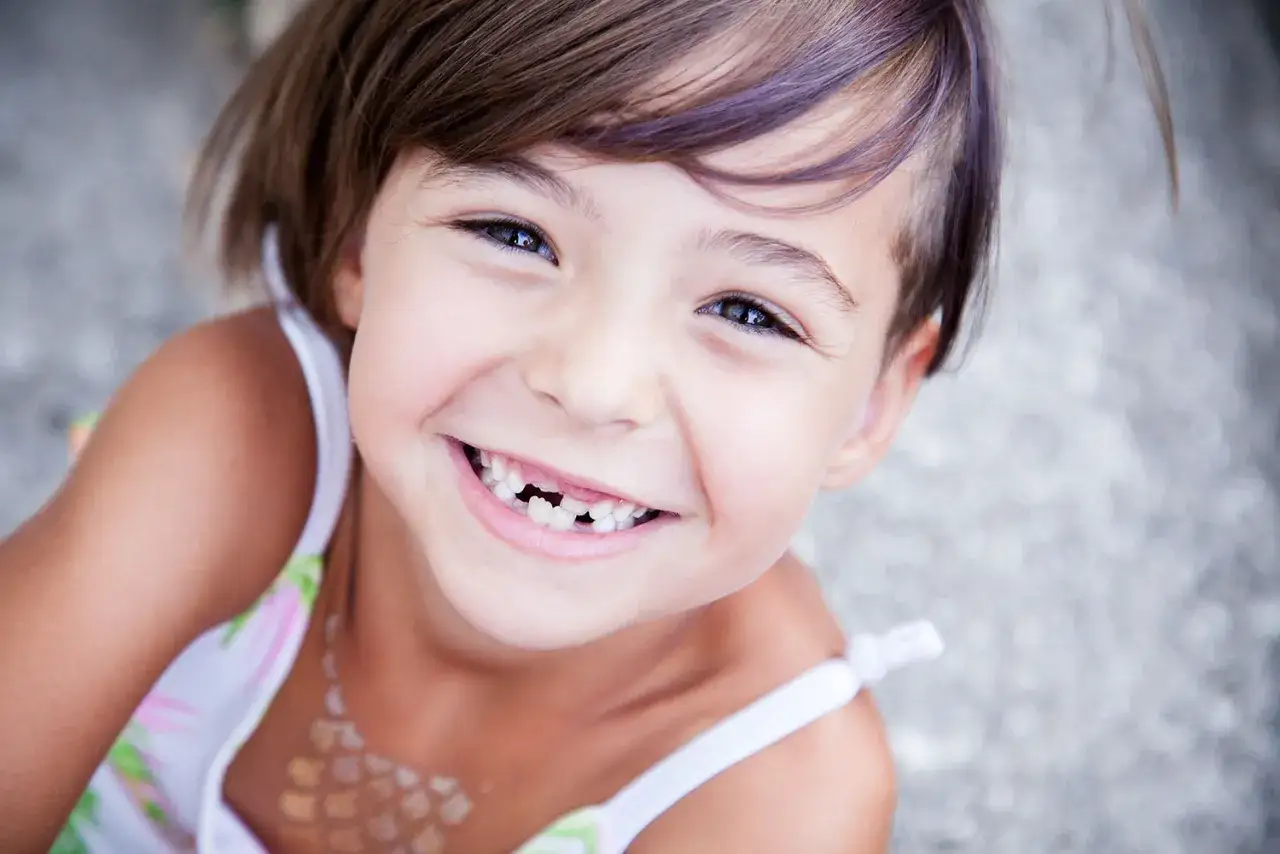 Niña sonriente con agenesia dental, mostrando su peculiar sonrisa.