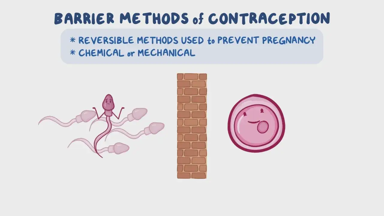 Esquema de m&eacute;todos anticonceptivos de barrera: espermatozoides chocan contra un muro de ladrillos, impidiendo llegar a un &oacute;vulo.