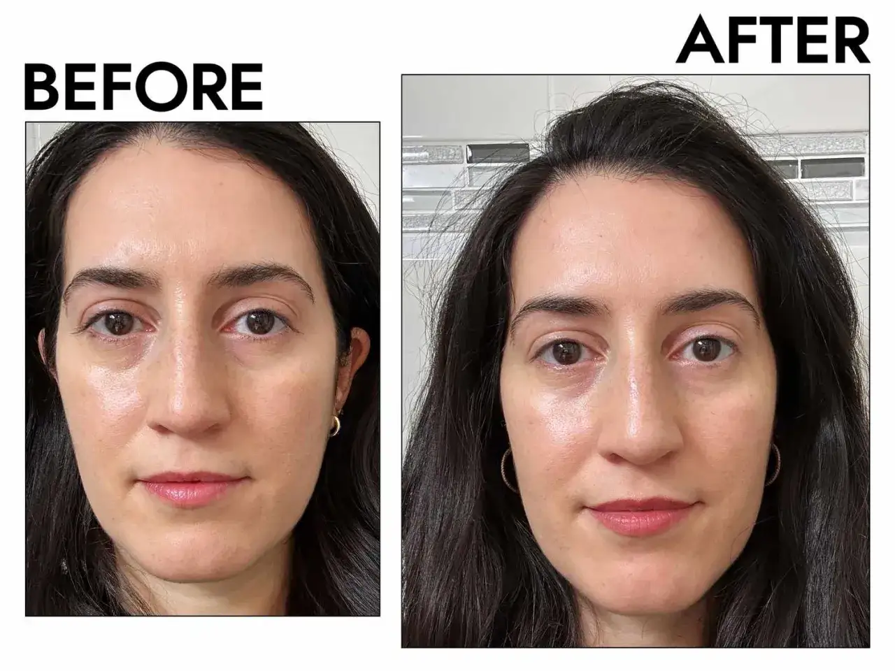 Prima e dopo: la pelle appare pi&ugrave; luminosa e uniforme. La niacinamide e zinco a cosa serve? A migliorare l'incarnato e ridurre le imperfezioni.