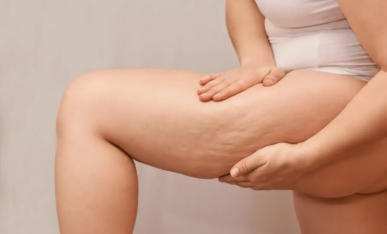 Manos tocando muslos con celulitis, buscando cómo eliminar la celulitis para una piel más lisa.