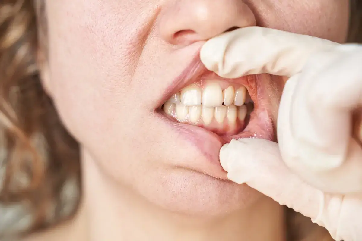Badanie jamy ustnej, zębów i dziąseł. Dowiedz się, czym jest periodontologia i jak dbać o zdrowie przyzębia.