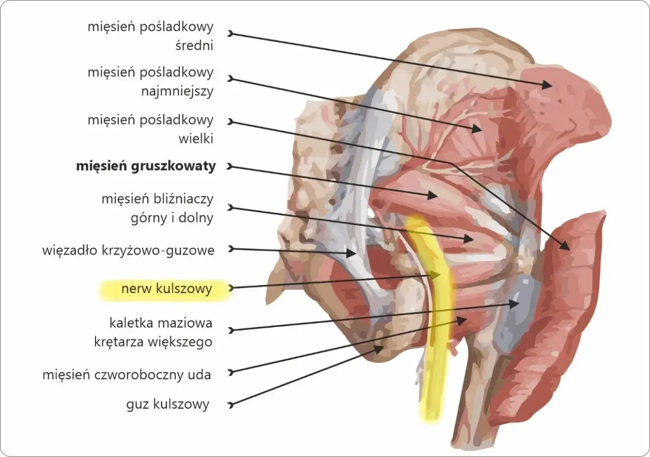 Anatomia pośladka z zaznaczonym nerwem kulszowym, kluczowym dla wykonania zastrzyku w pośladek.