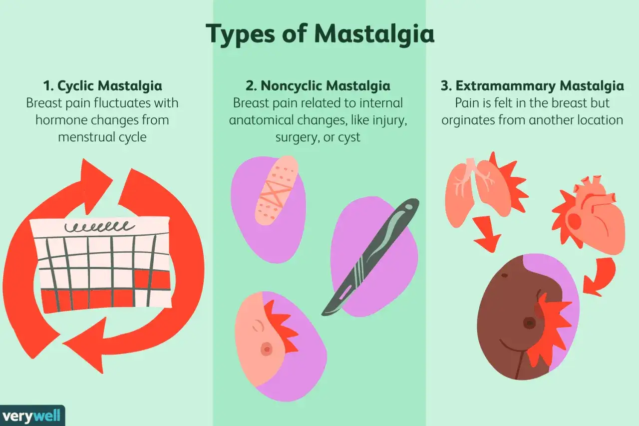 Rodzaje bólu piersi: cykliczny (związany z cyklem menstruacyjnym), niecykliczny (uraz, operacja, torbiel) i pozapiersiowy (ból odczuwany w piersi, ale pochodzący z innego miejsca).