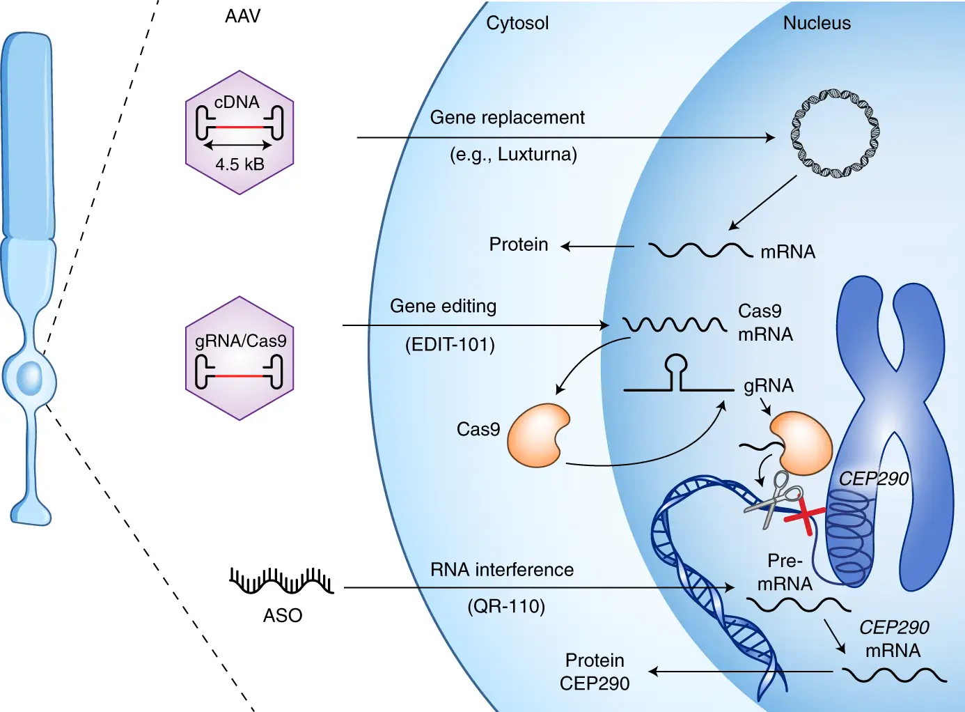 Illustrazione delle terapie geniche per l'amaurosi congenita di Leber: sostituzione genica, editing genico e RNA interference.