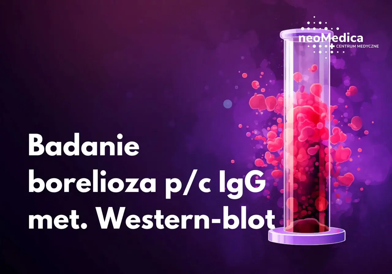 Badanie boreliozy metodą Western-blot. Dowiedz się, ile się czeka na wynik boreliozy.