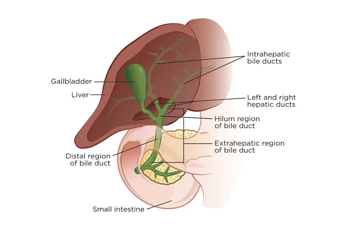 Anatomia dróg żółciowych, wątroby i pęcherzyka żółciowego. Ilustracja pokazuje, gdzie może rozwinąć się rak dróg żółciowych.