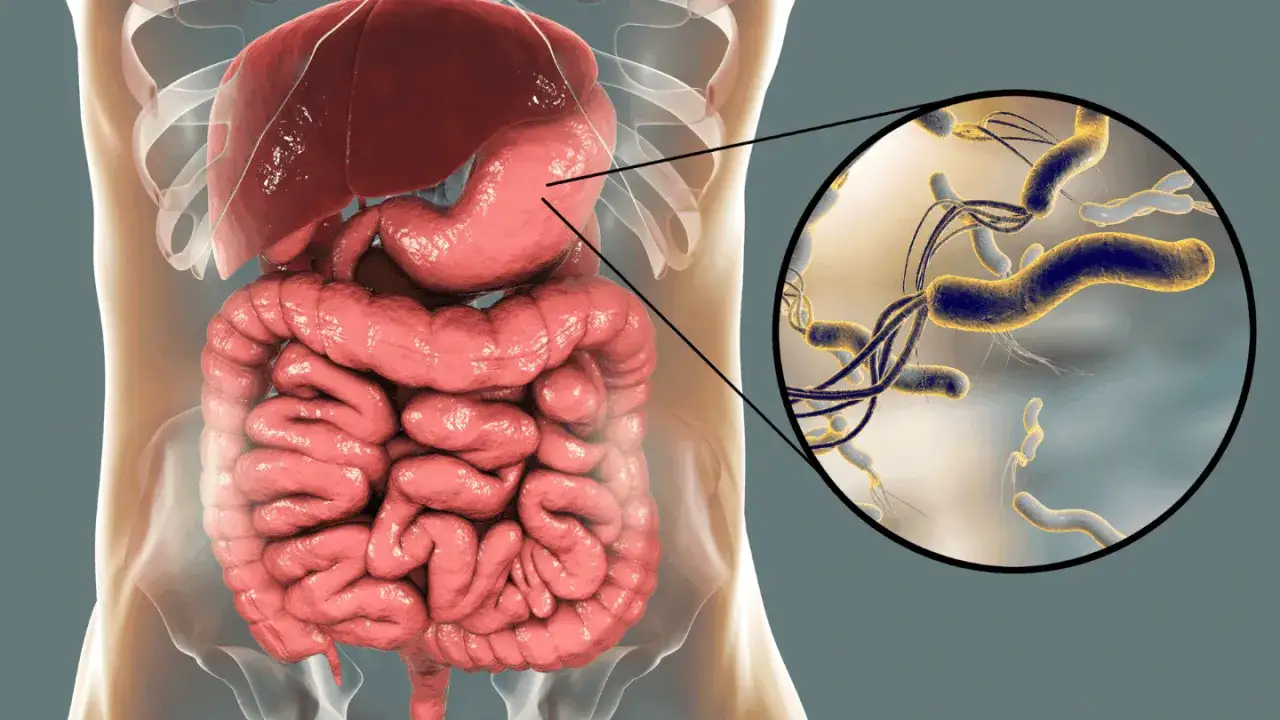 Układ pokarmowy człowieka z powiększeniem na bakterie Helicobacter pylori, kluczowe dla testu ureazowego.