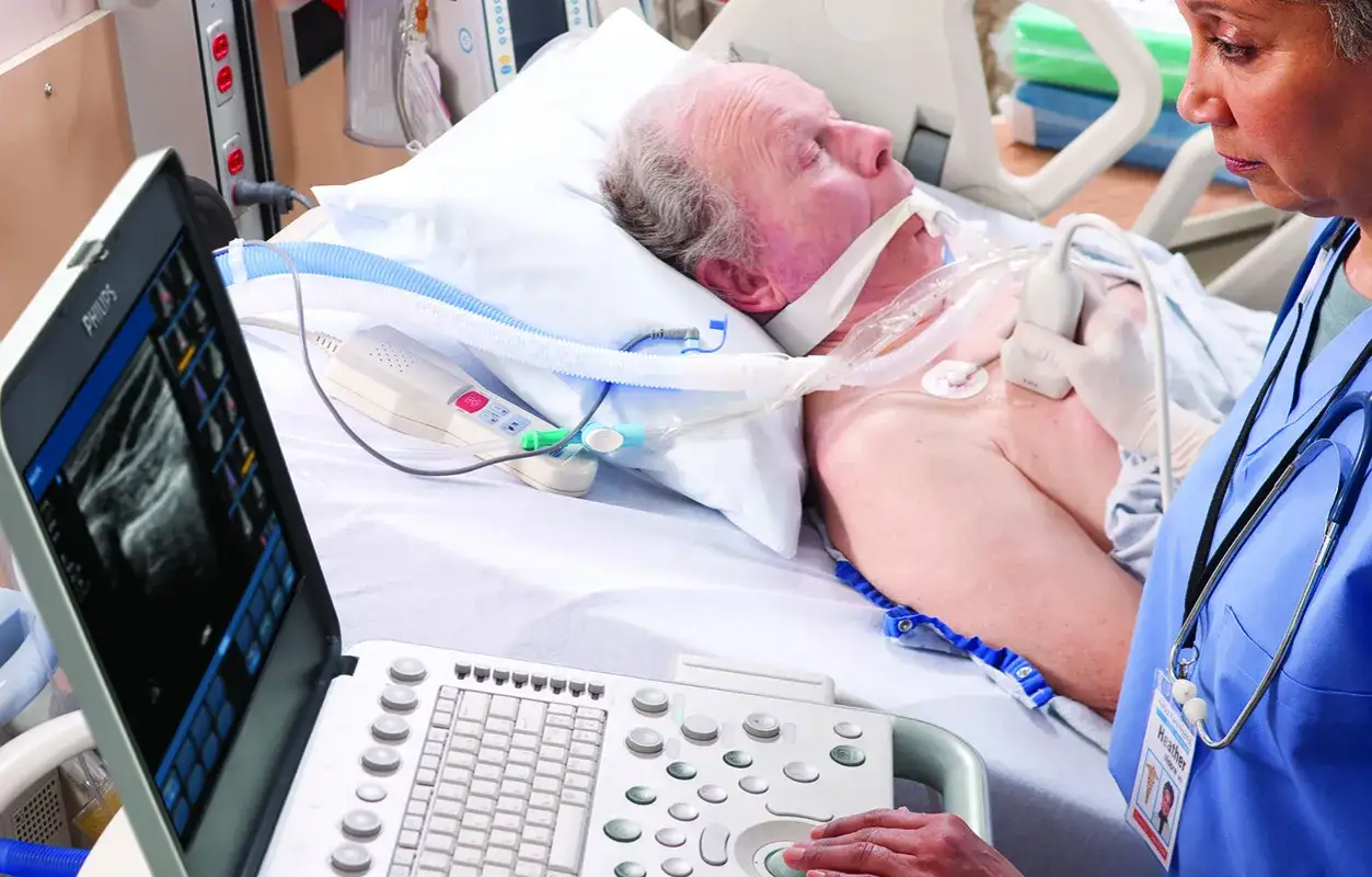 Lekarz wykonuje echo serca u pacjenta podłączonego do respiratora. Badanie USG pozwala ocenić pracę serca.